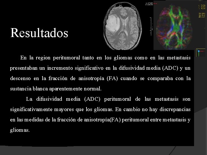 Resultados En la region peritumoral tanto en los gliomas como en las metastasis presentaban