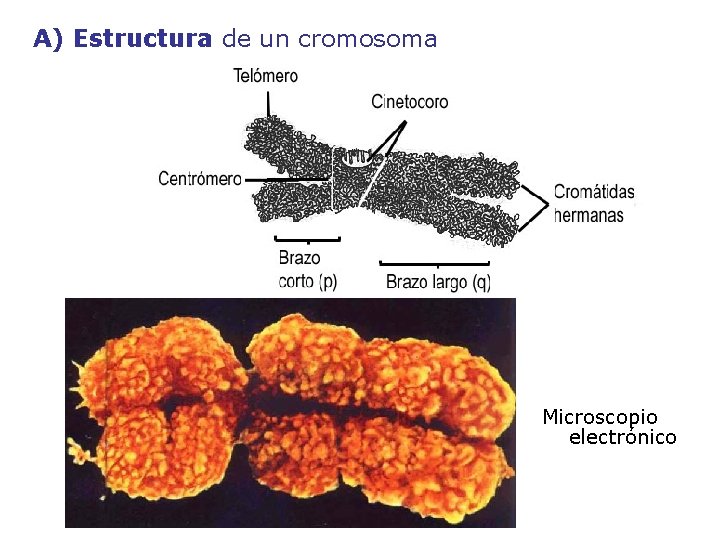 A) Estructura de un cromosoma Microscopio electrónico 