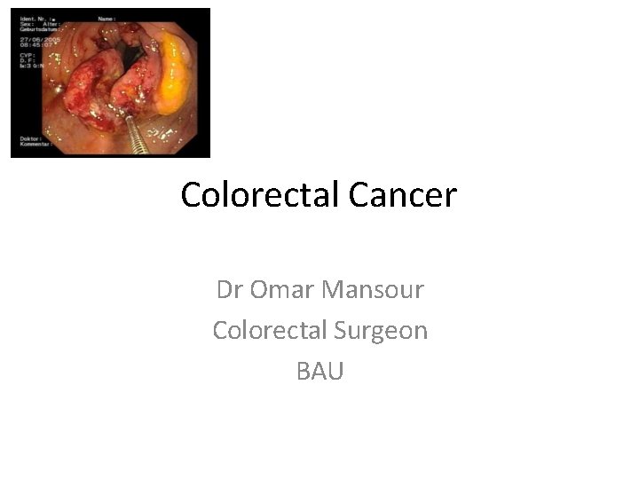 Colorectal Cancer Dr Omar Mansour Colorectal Surgeon BAU 