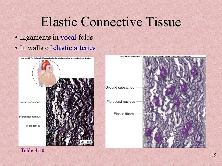 Elastic Connective Tissue • Ligaments in vocal folds • In walls of elastic arteries