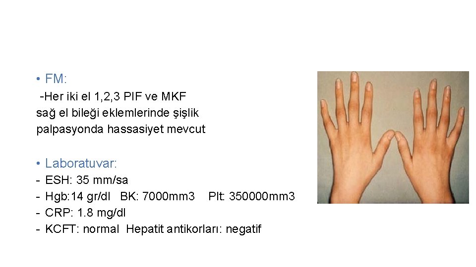  • FM: -Her iki el 1, 2, 3 PIF ve MKF sağ el
