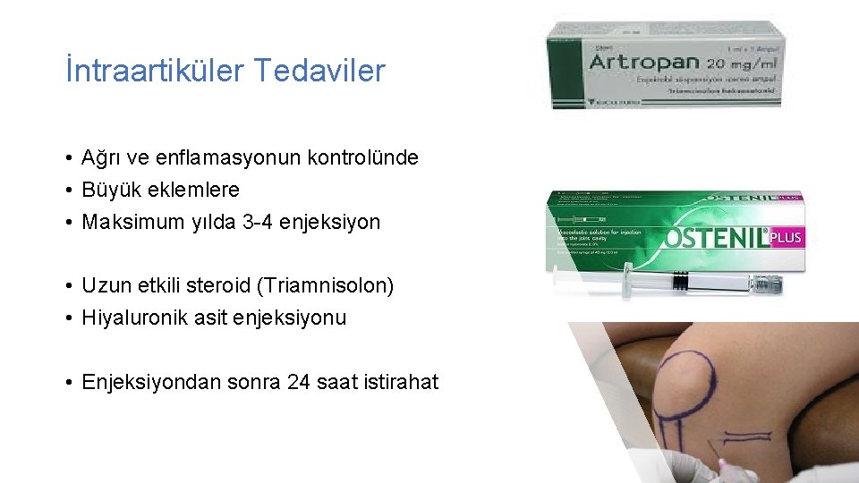 İntraartiküler Tedaviler • Ağrı ve enflamasyonun kontrolünde • Büyük eklemlere • Maksimum yılda 3