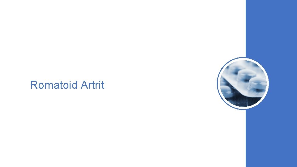 Romatoid Artrit 