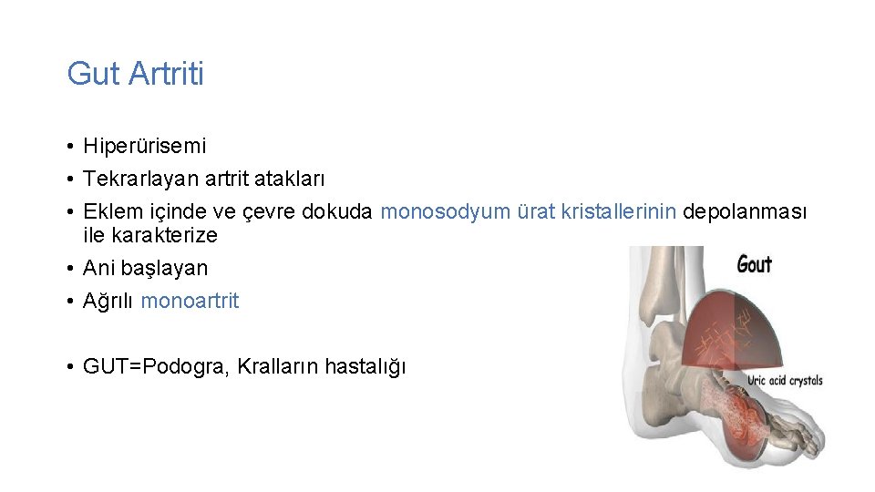 Gut Artriti • Hiperürisemi • Tekrarlayan artrit atakları • Eklem içinde ve çevre dokuda