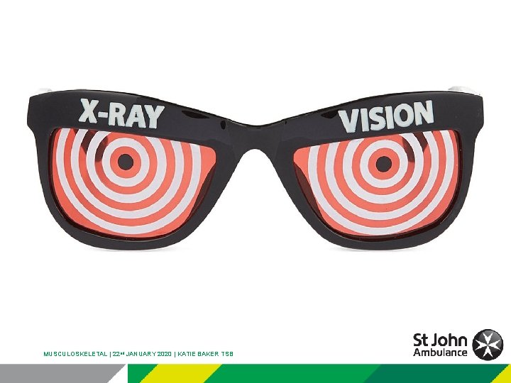 MUSCULOSKELETAL | 22 nd JANUARY 2020 | KATIE BAKER TSB 