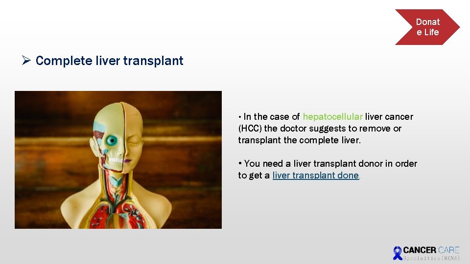 Donat e Life Ø Complete liver transplant • In the case of hepatocellular liver Donat e Life Ø Complete liver transplant • In the case of hepatocellular liver