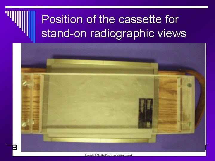 Position of the cassette for stand-on radiographic views 