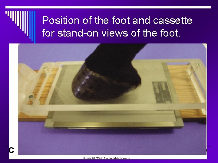 Position of the foot and cassette for stand-on views of the foot. 