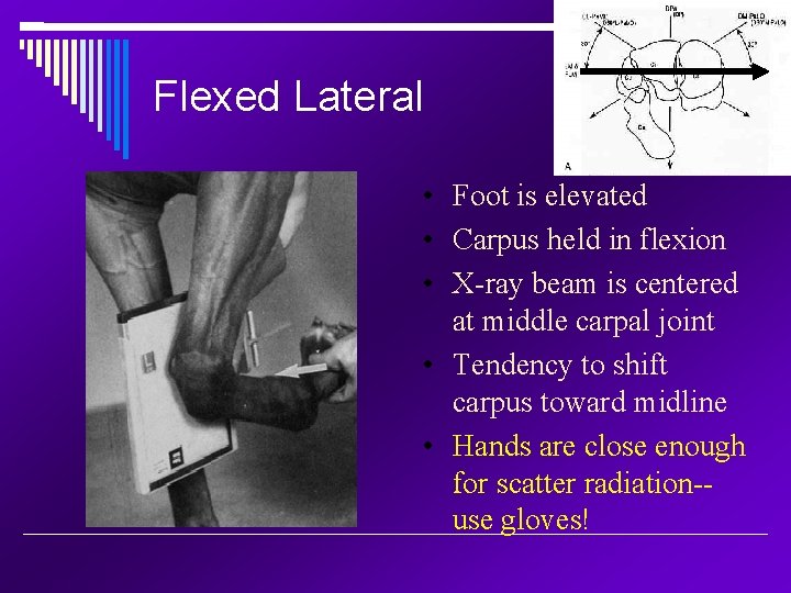 Flexed Lateral • Foot is elevated • Carpus held in flexion • X-ray beam