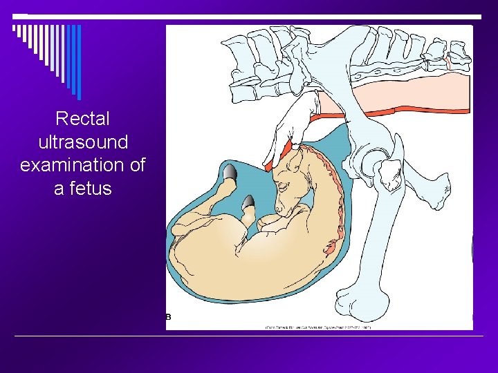 Rectal ultrasound examination of a fetus 
