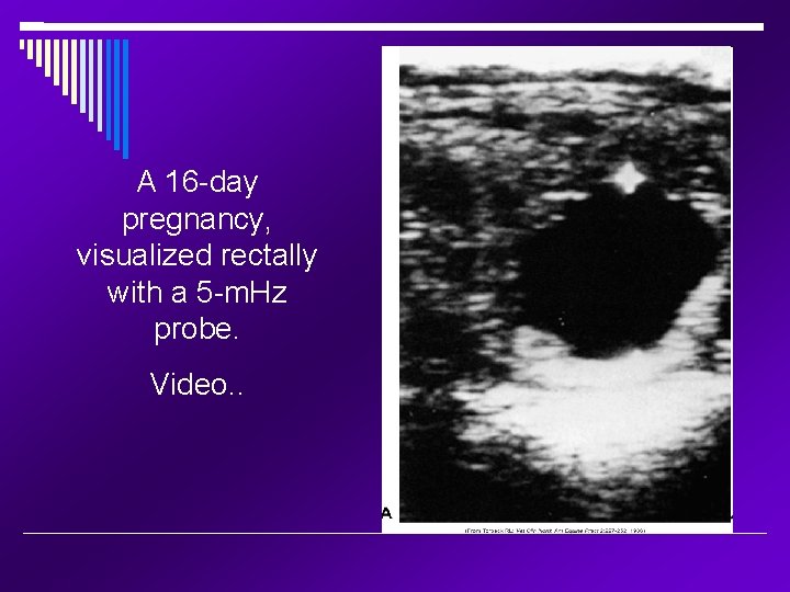 A 16 -day pregnancy, visualized rectally with a 5 -m. Hz probe. Video. .