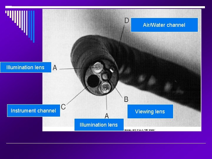 Air/Water channel Illumination lens Instrument channel Viewing lens Illumination lens 