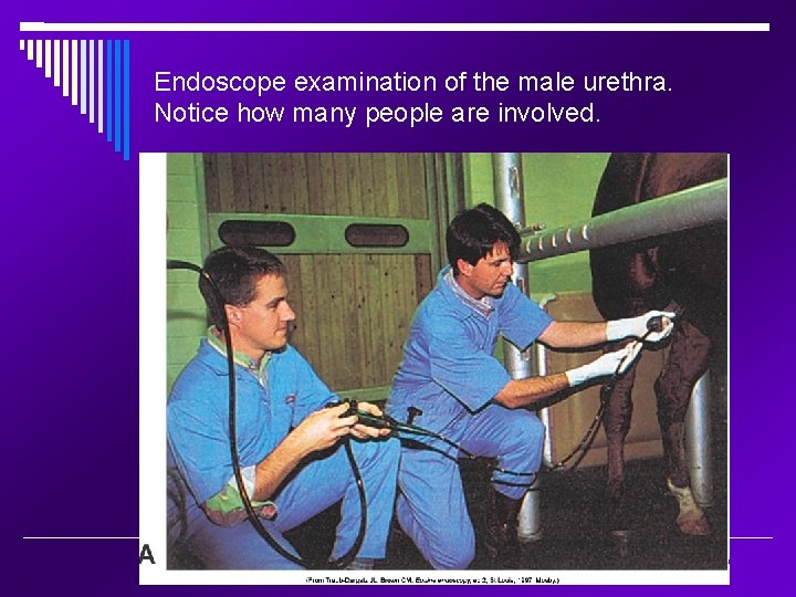 Endoscope examination of the male urethra. Notice how many people are involved. 