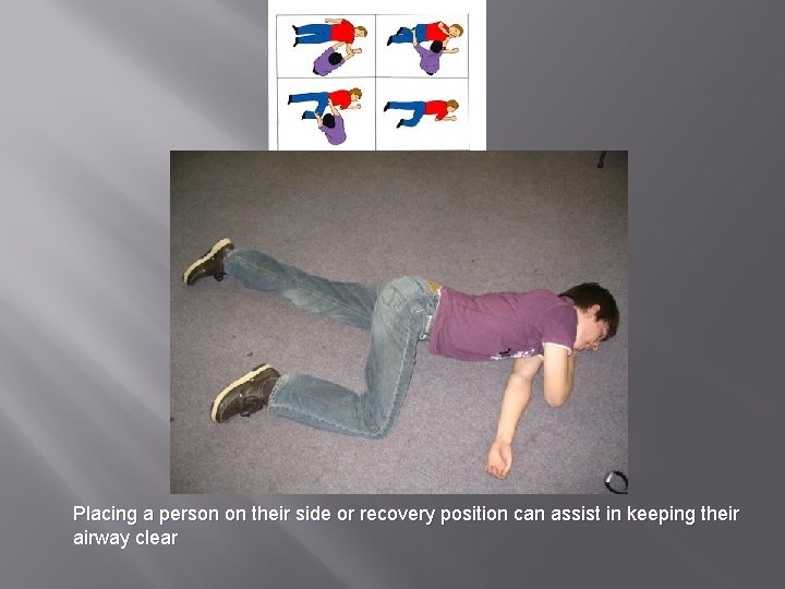 Placing a person on their side or recovery position can assist in keeping their