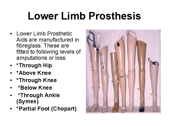 Lower Limb Prosthesis • Lower Limb Prosthetic Aids are manufactured in fibreglass. These are