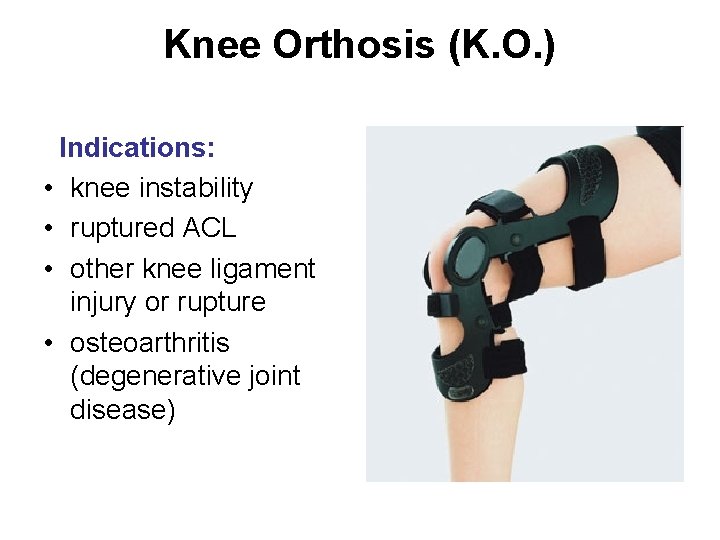 Knee Orthosis (K. O. ) Indications: • knee instability • ruptured ACL • other