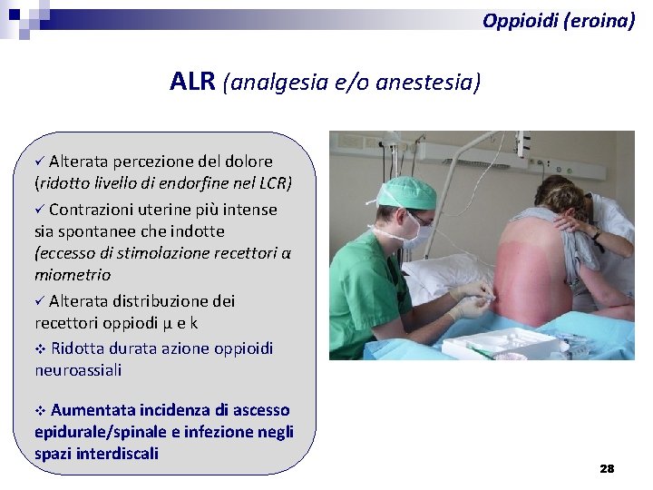 Oppioidi (eroina) ALR (analgesia e/o anestesia) ü Alterata percezione del dolore (ridotto livello di