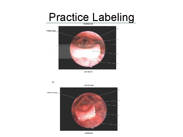 Practice Labeling 