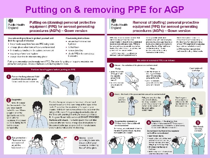 Putting on & removing PPE for AGP Inform Promote Sustain 