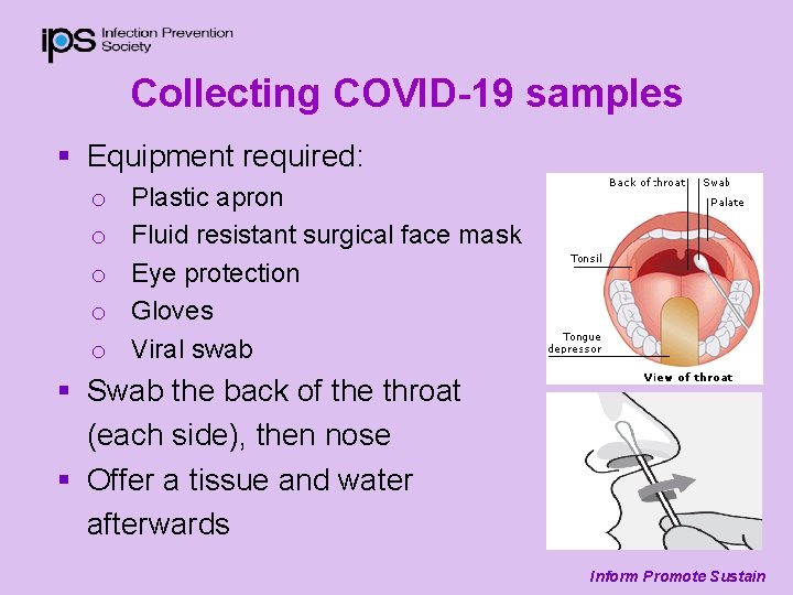 Collecting COVID-19 samples § Equipment required: o o o Plastic apron Fluid resistant surgical