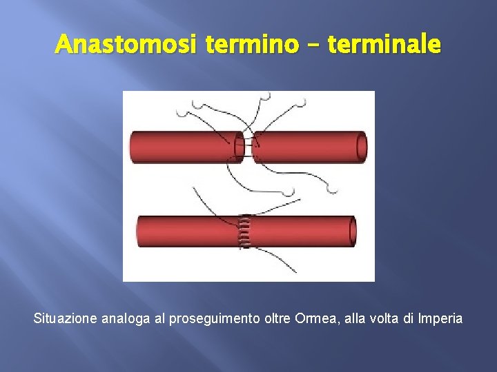 Anastomosi termino – terminale Situazione analoga al proseguimento oltre Ormea, alla volta di Imperia