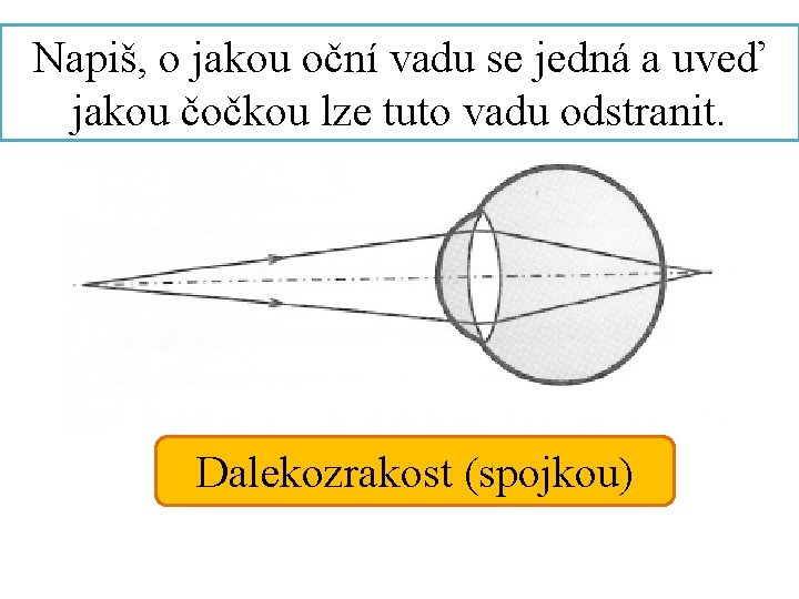 Napiš, o jakou oční vadu se jedná a uveď jakou čočkou lze tuto vadu