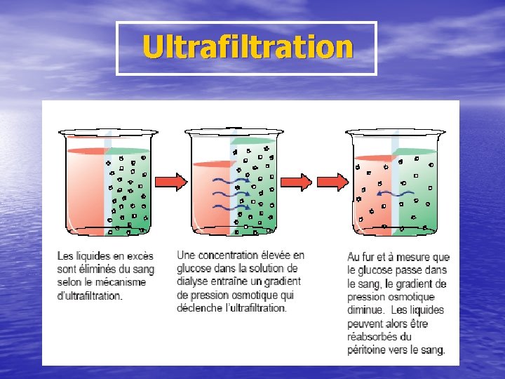 Ultrafiltration 
