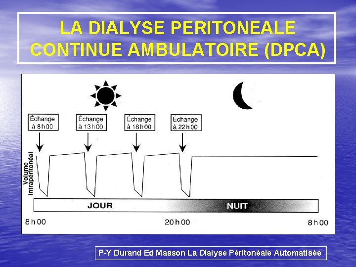 LA DIALYSE PERITONEALE CONTINUE AMBULATOIRE (DPCA) P-Y Durand Ed Masson La Dialyse Péritonéale Automatisée