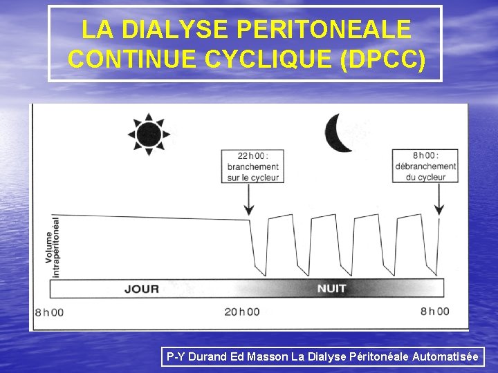 LA DIALYSE PERITONEALE CONTINUE CYCLIQUE (DPCC) P-Y Durand Ed Masson La Dialyse Péritonéale Automatisée