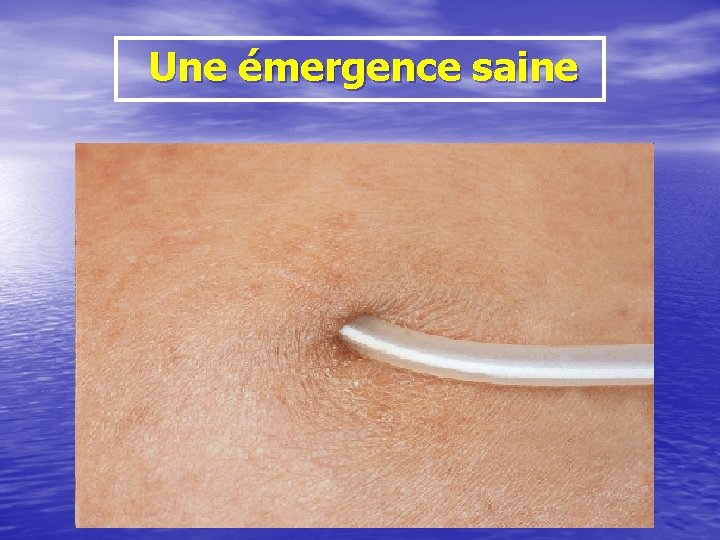 Une émergence saine 