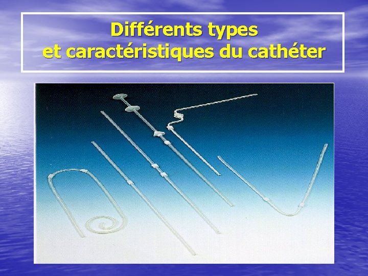 Différents types et caractéristiques du cathéter 