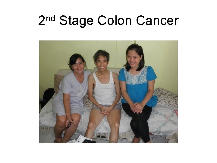 2 nd Stage Colon Cancer 