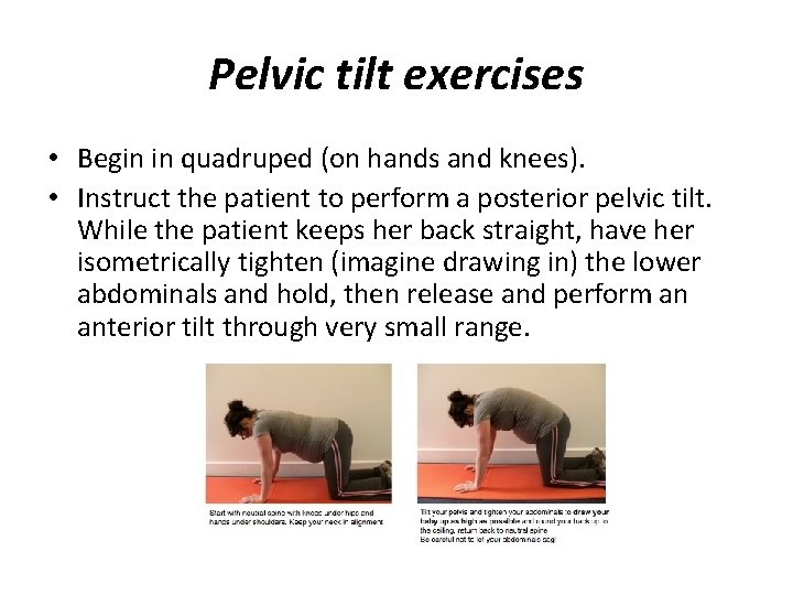 Pelvic tilt exercises • Begin in quadruped (on hands and knees). • Instruct the