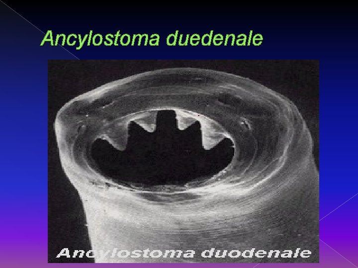 Ancylostoma duedenale 