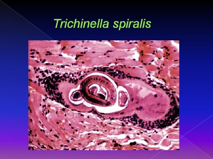 Trichinella spiralis 