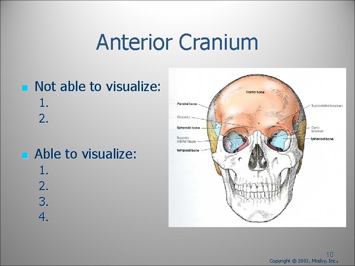 Anterior Cranium n Not able to visualize: 1. 2. n Able to visualize: 1. Anterior Cranium n Not able to visualize: 1. 2. n Able to visualize: 1.