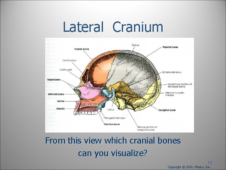 Lateral Cranium From this view which cranial bones can you visualize? 12 Copyright © Lateral Cranium From this view which cranial bones can you visualize? 12 Copyright ©
