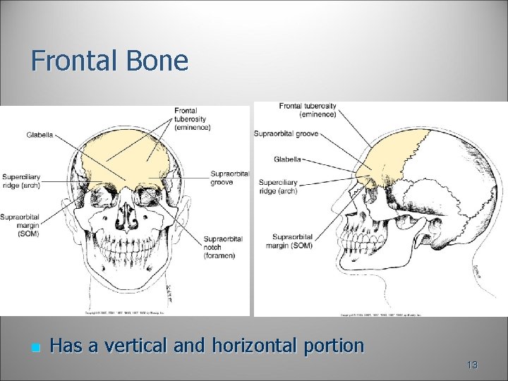 Frontal Bone n Has a vertical and horizontal portion 13 Frontal Bone n Has a vertical and horizontal portion 13