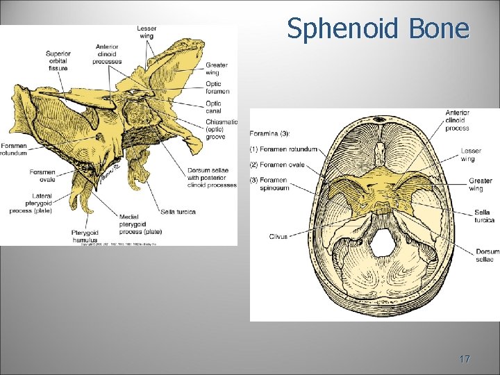 Sphenoid Bone 17 Sphenoid Bone 17