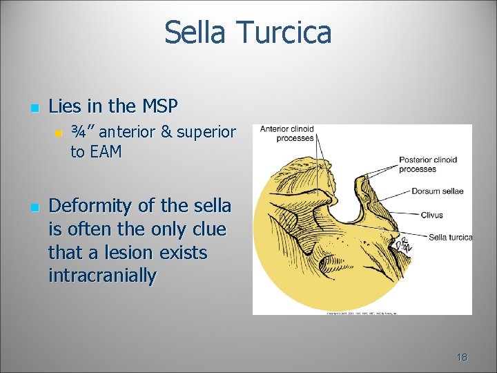 Sella Turcica n Lies in the MSP n n ¾” anterior & superior to Sella Turcica n Lies in the MSP n n ¾” anterior & superior to