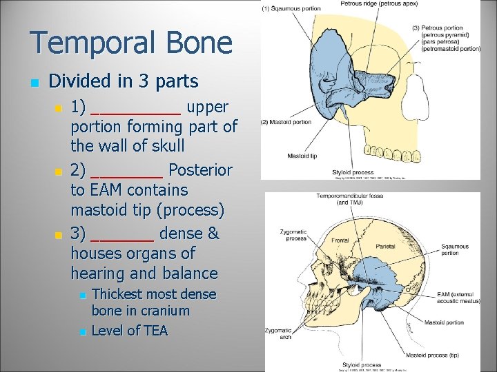 Temporal Bone n Divided in 3 parts n n n 1) _____ upper portion Temporal Bone n Divided in 3 parts n n n 1) _____ upper portion