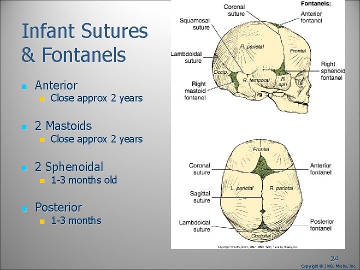 Infant Sutures & Fontanels n Anterior n n 2 Mastoids n n Close approx Infant Sutures & Fontanels n Anterior n n 2 Mastoids n n Close approx