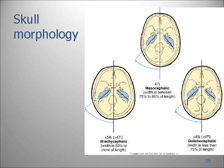 Skull morphology 29 Skull morphology 29