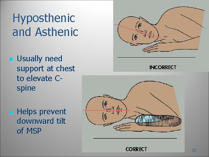 Hyposthenic and Asthenic n n Usually need support at chest to elevate Cspine Helps Hyposthenic and Asthenic n n Usually need support at chest to elevate Cspine Helps
