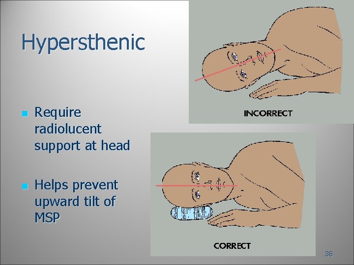 Hypersthenic n n Require radiolucent support at head Helps prevent upward tilt of MSP Hypersthenic n n Require radiolucent support at head Helps prevent upward tilt of MSP