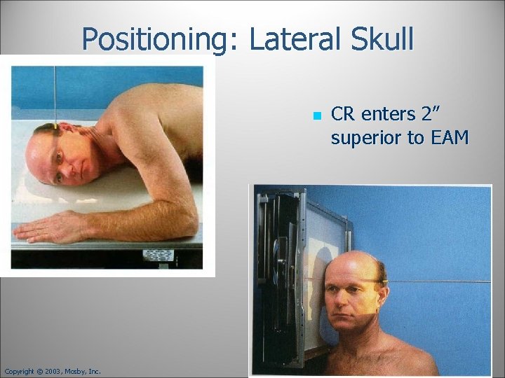 Positioning: Lateral Skull n Copyright © 2003, Mosby, Inc. CR enters 2” superior to Positioning: Lateral Skull n Copyright © 2003, Mosby, Inc. CR enters 2” superior to