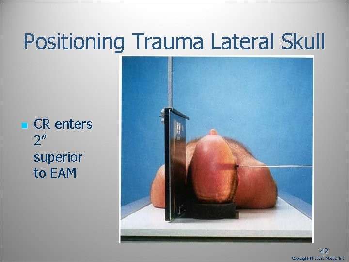 Positioning Trauma Lateral Skull n CR enters 2” superior to EAM 42 Copyright © Positioning Trauma Lateral Skull n CR enters 2” superior to EAM 42 Copyright ©
