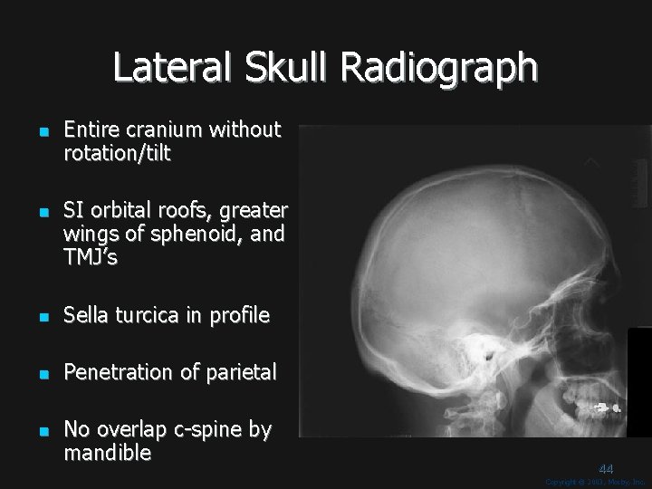 Lateral Skull Radiograph n n Entire cranium without rotation/tilt SI orbital roofs, greater wings Lateral Skull Radiograph n n Entire cranium without rotation/tilt SI orbital roofs, greater wings