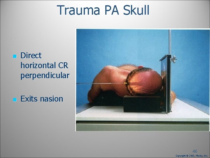 Trauma PA Skull n n Direct horizontal CR perpendicular Exits nasion 46 Copyright © Trauma PA Skull n n Direct horizontal CR perpendicular Exits nasion 46 Copyright ©