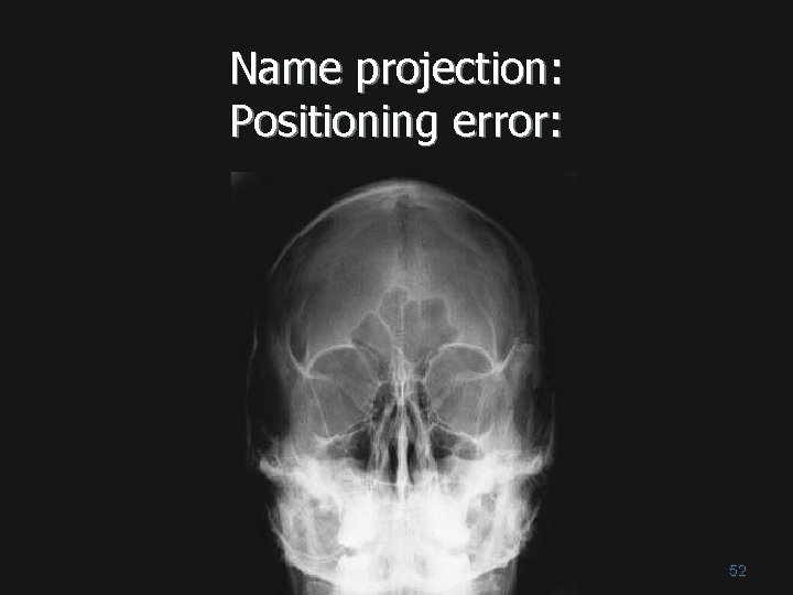 Name projection: Positioning error: 52 Name projection: Positioning error: 52